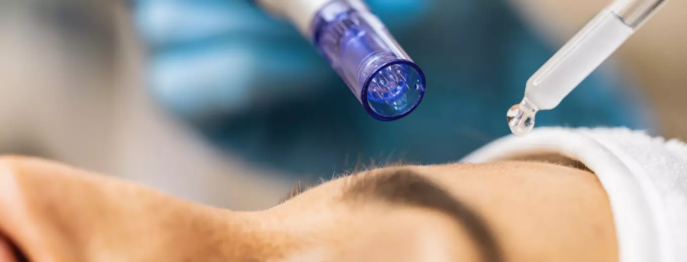 MICRONEEDLING MARTINIQUE