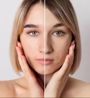 NOA massages & bien-être / Hydrafacial / massages bien-être / Mix massage art: mélange de différentes techniques (californien, thaï, lomi-lomi, deep tissue…)